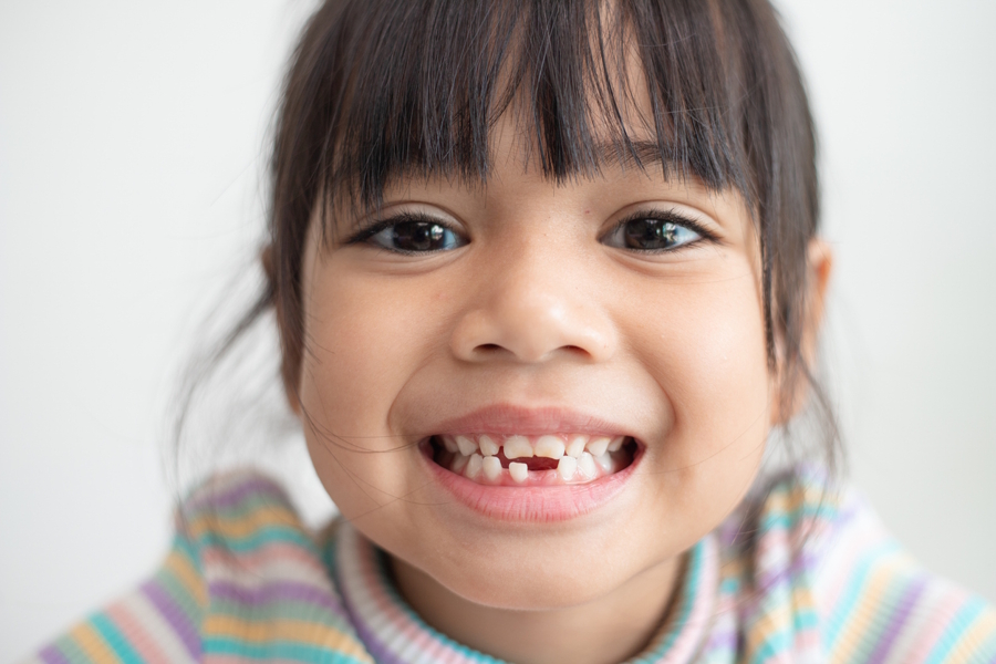 Young girl smiling and missing a bottom front tooth