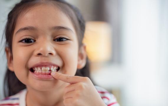 little girl with lost tooth