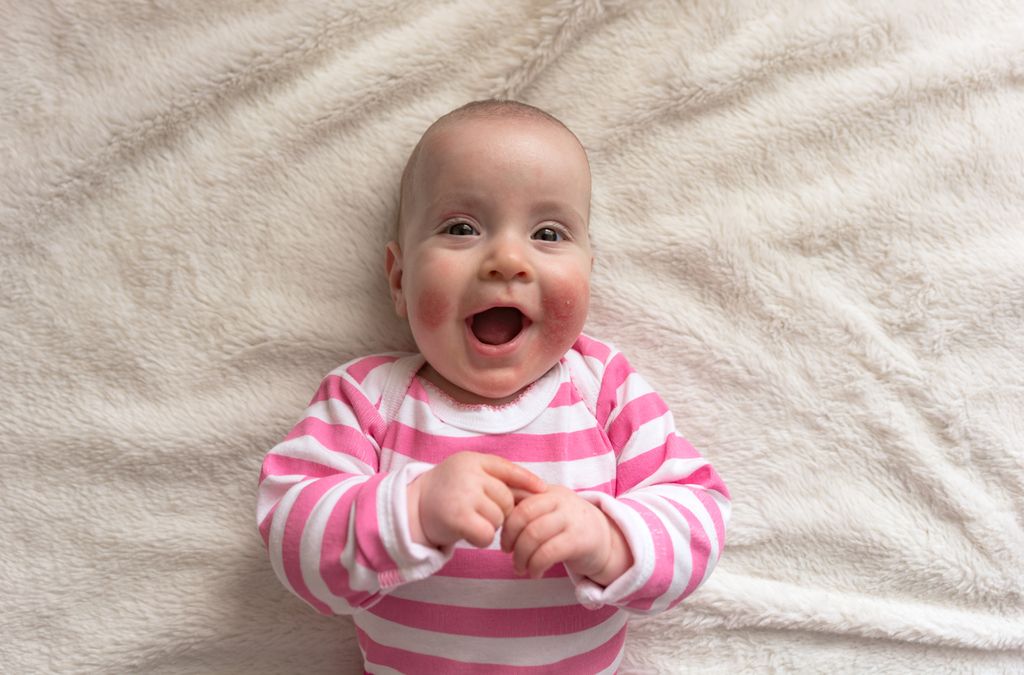 Rash Guard: When to Worry About Baby’s Skin