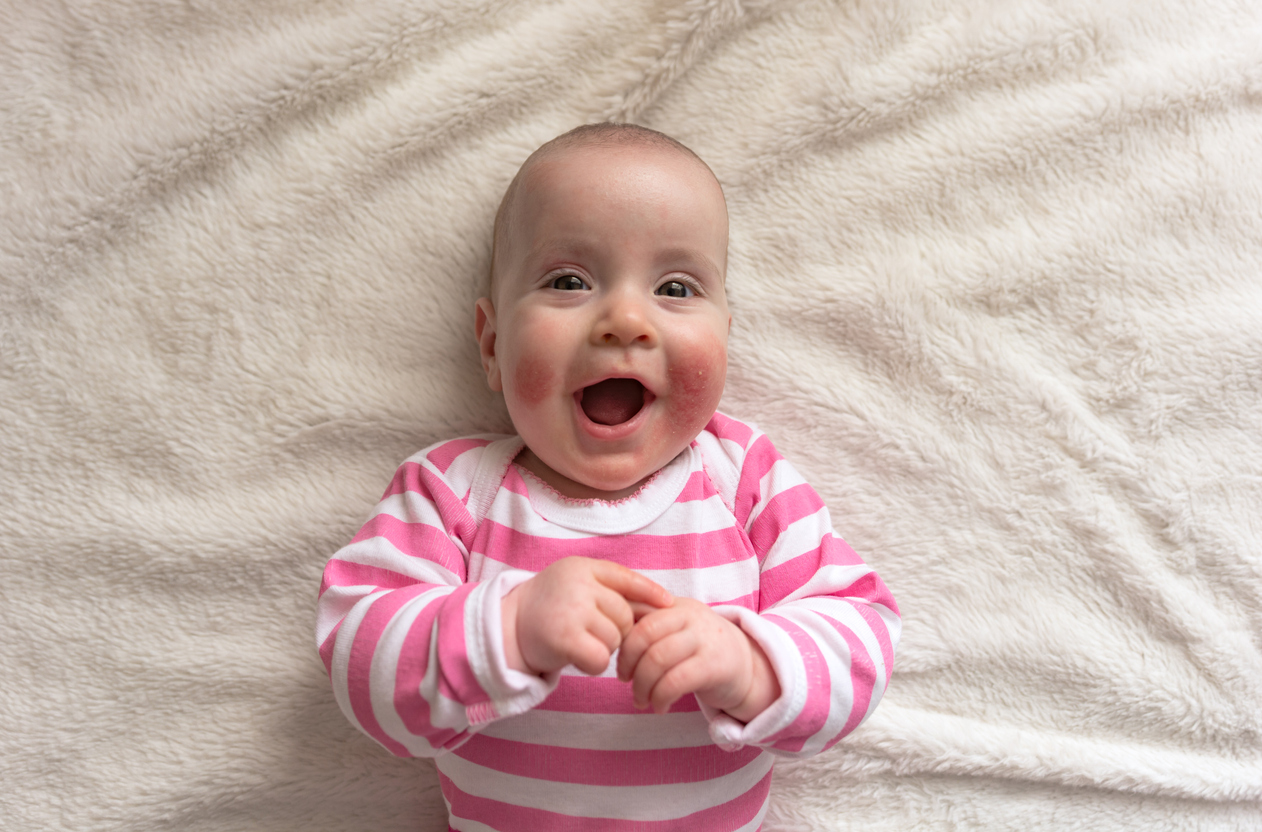 happy smiling baby with red cheeks on a blanket